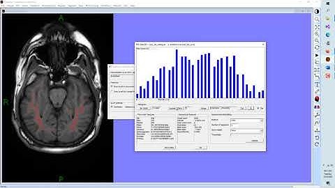 FireVoxel Radiomics Features 2D Basic Operation