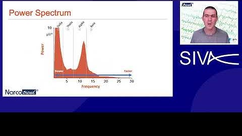Visualising the EEG as presented by Dr Mark Barley @SIVA 2021 (you also find the SIVA2020 talk here)
