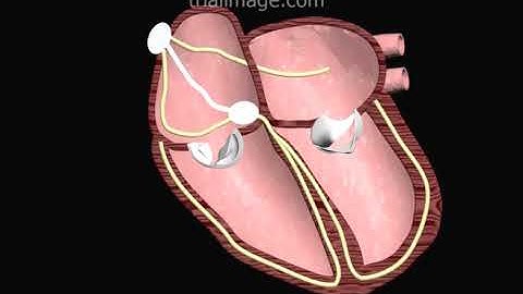 What Makes Your Heart Beat? Cardiac Electrophysiology Animation by Cal Shipley, M.D.