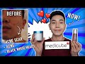 HOW I TREATED MY FACE WITH MEDICUBE? THIS SERUM CAN REMOVE ACNE SCARS! - JONATHAN HO