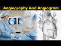 What is angiography and angiogram  how angiography is performed 3d animation