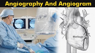 What is Angiography and Angiogram? | How Angiography is performed? (3D Animation)