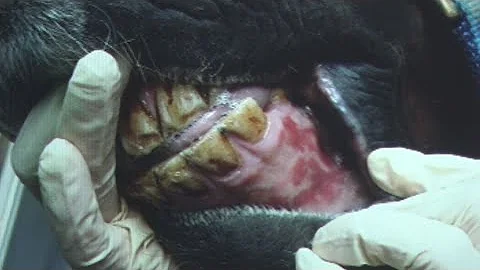 Jak poznat bolest jater?