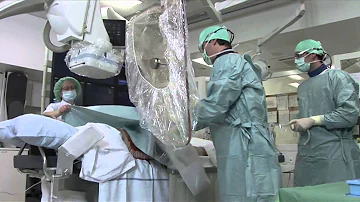 Come capire se hai le arterie ostruite?