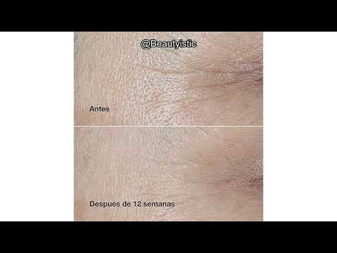 Clinique Smart Clinical Repair Review: Is This Anti-Aging Cream Worth It?