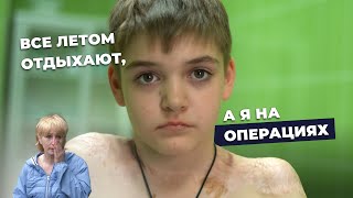 ХИРУРГИЯ НЕВУСОВ: ОСЛОЖНЕНИЯ | История Дениса Кеняйкина