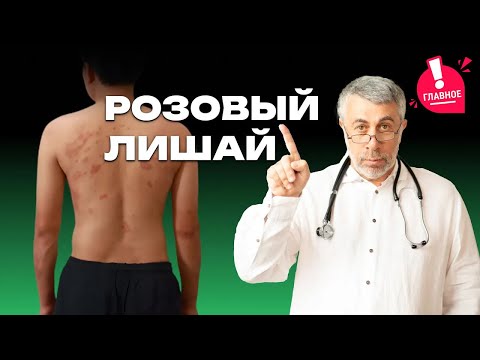 Розовый лишай Жибера