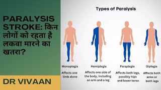 Paralysis || Paralysis Kaise Hota Hai || लकवा के लक्षण, कारण || Paralysis Symptoms , Cause ?