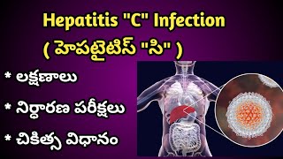 Hepatitis C Infection Causes, Symptoms and treatment in Telugu | హెపటైటిస్ " సి " లక్షణాలు, చికిత్స