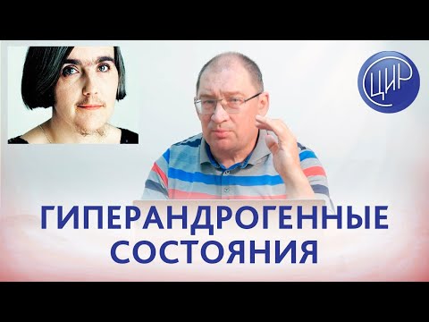 Причины бесплодия: гиперандрогения, СПКЯ, адреногенитальный синдром. Гузов И.И.