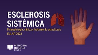 🩺 Esclerosis Sistémica – Fisiopatología, Clínica y Tratamiento actualizado | Medicina Interna Educa