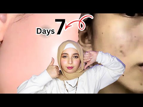 ف7 ايام نضارة بشرتك فى4خطوات بعد تعب الجامعة والامتحانات تفتيح البشرة     4 