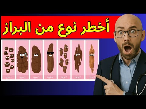 أخطر نوع من البراز إذا رأيته لا تتجاهله أبدا