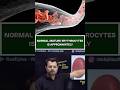Normal mature erythrocytes is approximately part 3 #chandanmlt #rankplus #labtechnicianclasses
