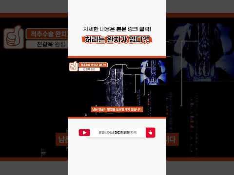 허리 질환 완치가 없다!?