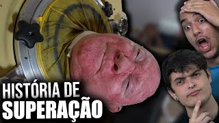 Conheça o homem que está preso há mais de 60 anos em uma máquina