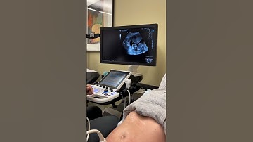 Ultrasound practice reveals a surprise #shorts