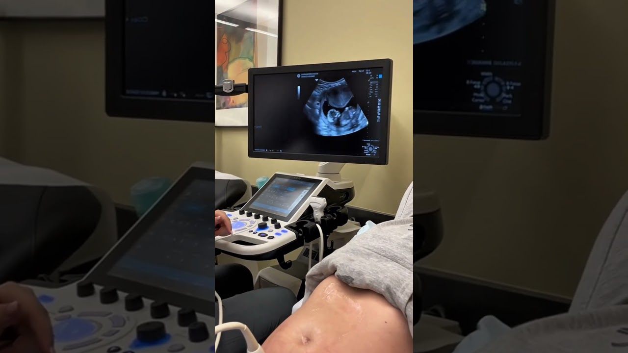 Ultrasound practice reveals a surprise 