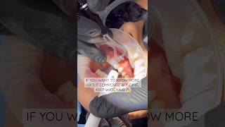 Stunning smile by Dr. Josh #compositebonding