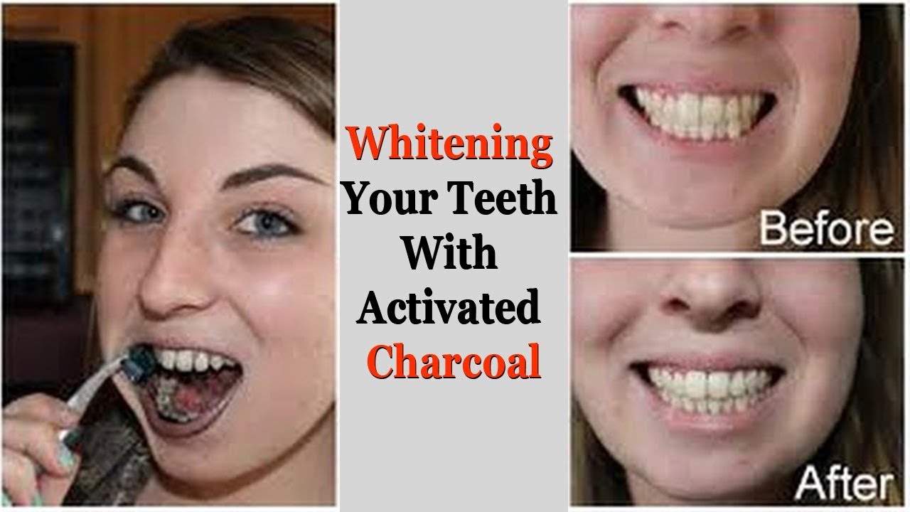 Whitening Your Teeth With Activated Charcoal YouTube