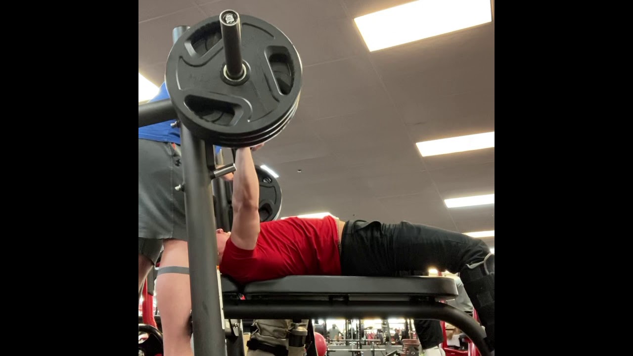 315 Bench Press 13 weeks after surgery 335 in 2
