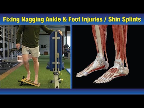 Fix Shin Splints FOREVER: The Glute Protocol That Stops Pain & Prevents Ankle Sprains