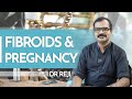 Fibroids  pregnancy