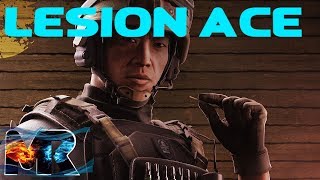 Ace With Every Operator - Rainbow Six Siege