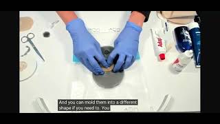 Peel and Seal and Pouch - Fistula and Ostomy management