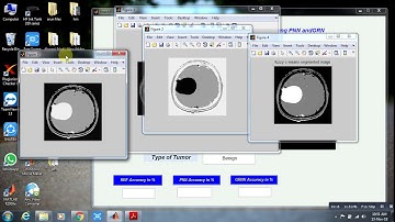 Brain Tumour Detection in MRI Images using PNN and GRNN