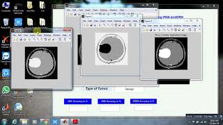 Brain Tumour Detection in MRI Images using PNN and GRNN