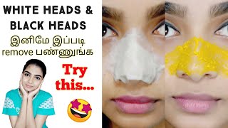 How to Remove WHITEHEADS AND BLACKHEADS at home | TAMIL | Trendy Girl Tamil - TGT |