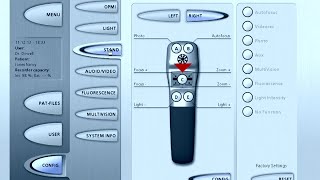 How to configure the hand grip and foot controls on the ZEISS OPMI PENTERO microscope