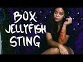 BOX Jellyfish STING!!!! (Bantayan Island Philippines)