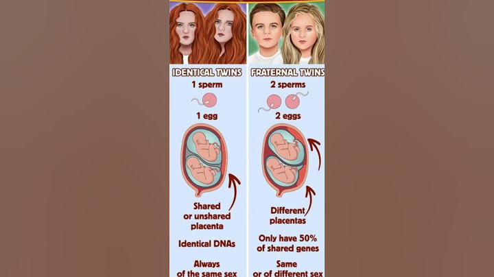 Identical twins vs Fraternal Twins #shorts #youtubeshorts #twins