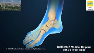 Ankle Scope – CIMS Hospital