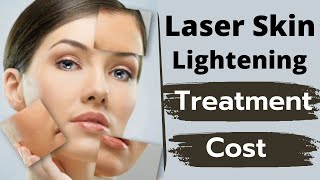 ✅ Laser Skin Lightening/Whitening Treatment And Cost |🔥लेज़र ट्रीटमेंट मे कितना खर्चा आता है