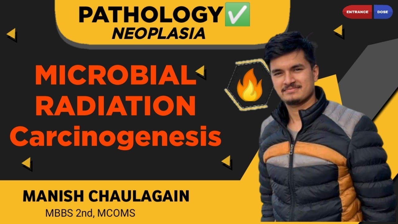 5.12 Microbial & Radiation Carcinogenesis || Neoplasia ||