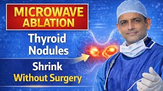 Microwave Ablation (MWA) Explained! Thyroid Nodule Treatment Without Surgery .
