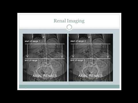 CT Scan Abdomen