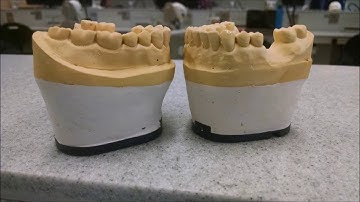 Mounting Dental Models