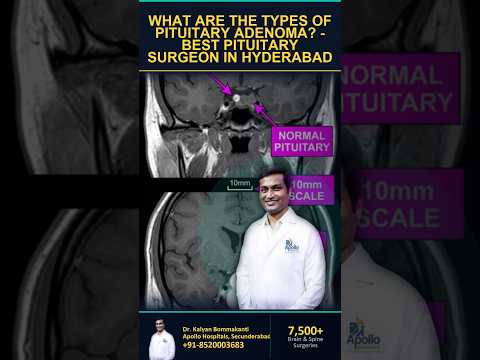 What Are the Types of Pituitary Adenoma? - Best Pituitary Surgeon in Hyderabad