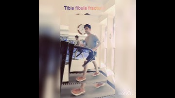 opration date 5 July 2022 video suit date 2 may 2023( tibia fibula fracture) after 10 month Running