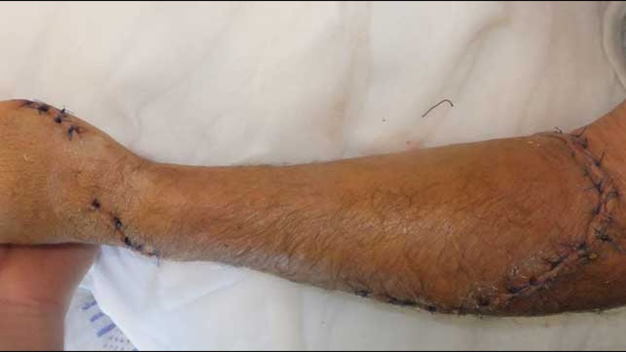 sharknado 5 Témoignage de Dave PEARSON, survivant d'une attaque de requin bouledogue en 2011 - 27/03/2019