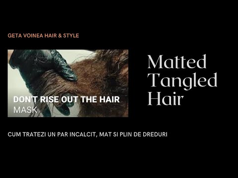 Matted Tangled Hair - scalp with serious seborrhea, par incalcit facut dred tot capul