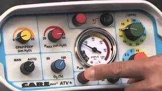 O-Two CAREvent ATV+ ve O-Two CAREvent MRI Transport Mekanik Ventilatör Özellikleri Nelerdir