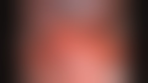 Uniportal VATS thoracoscopic segmentectomy lung cancer