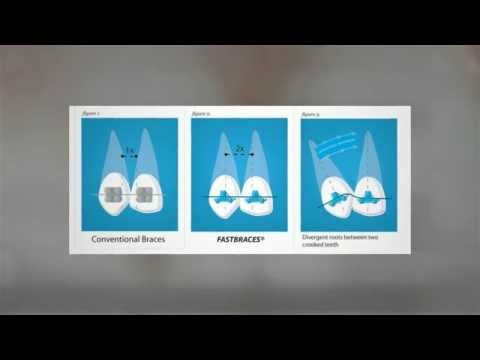 Video thumbnail: Patient video
