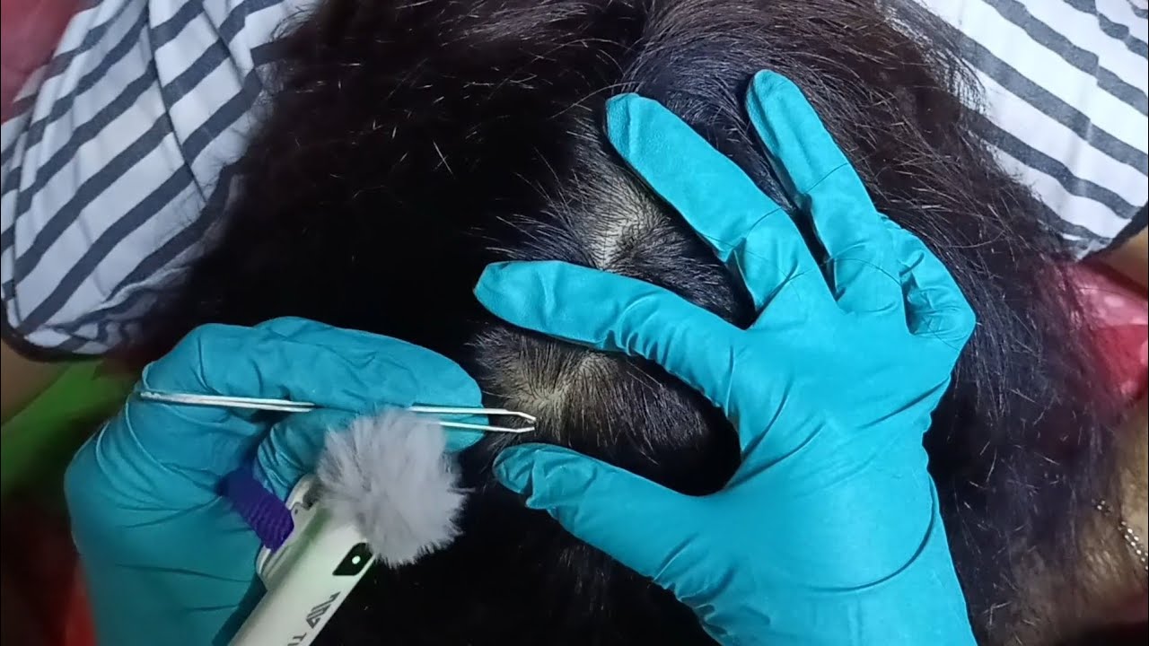 ASMR Scalp Cleaning: Scratching for Dandruff