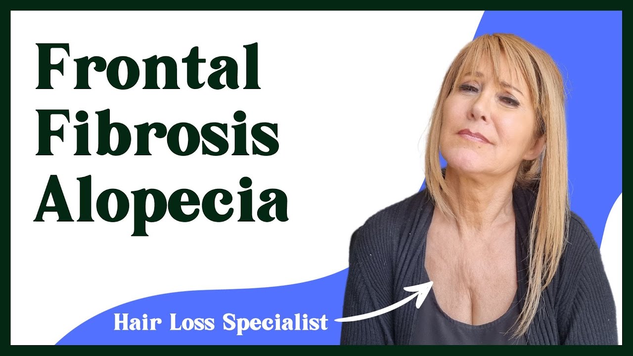 frontal-fibrosis-alopecia-hair-loss-specialist-responds-youtube